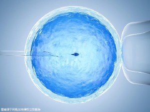 精液分析