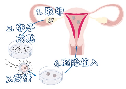 关于私人孕妈供卵代怀服务选性别